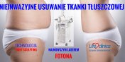 Nieinwazyjne laserowe usuwanie tuszczu