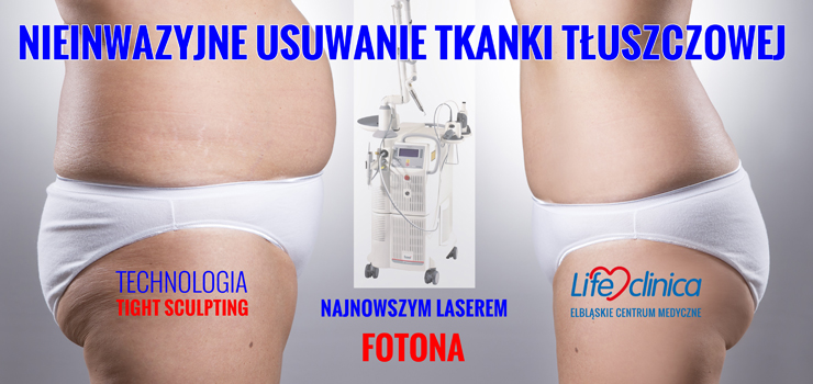 Nieinwazyjne laserowe usuwanie tuszczu