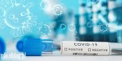 Wirusolog dla Radia ZET: W Polsce coraz wicej osb z koronawirusem, ponad 20% testw jest pozytywnych